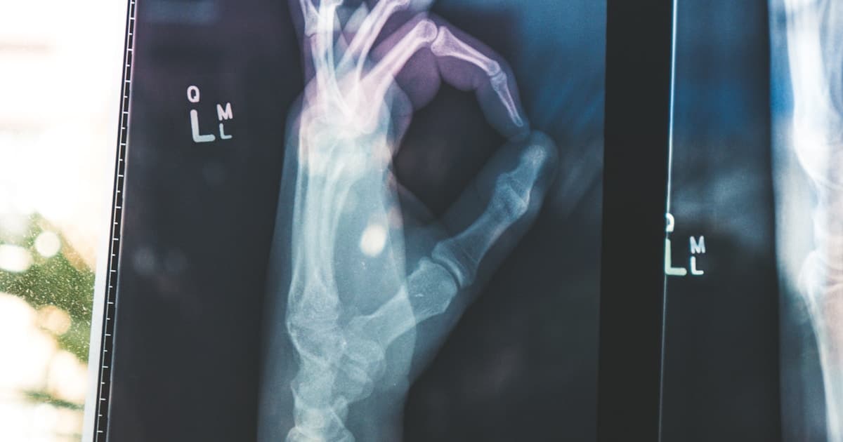 IA na Medicina: Como Usar para Aumentar Produtividade sem Riscos